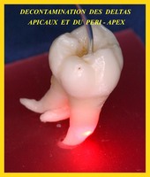 décontamination au-delà réseau canalaire